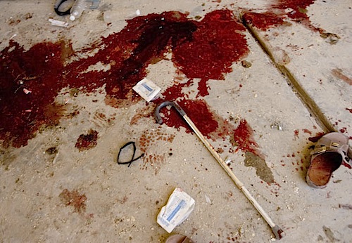 zoriah_iraq_war_fallujah_suicide_bomb_blood_cane_shoe