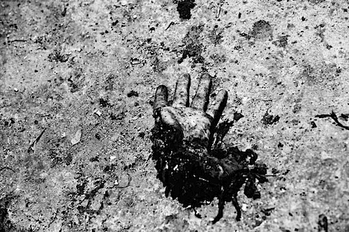 zoriah_iraq_war_fallujah_suicide_bomb_body_parts_hand